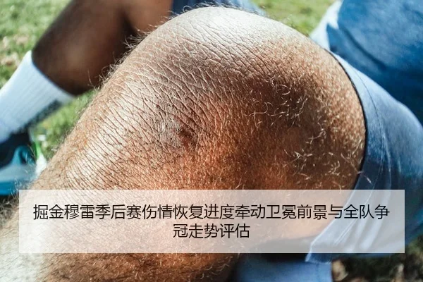 掘金穆雷季后赛伤情恢复进度牵动卫冕前景与全队争冠走势评估